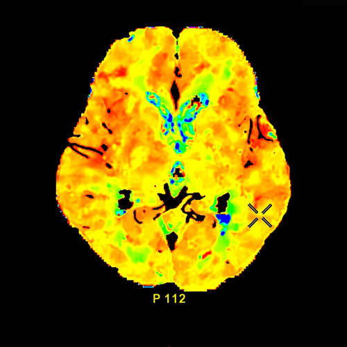 Neuroradiology Services