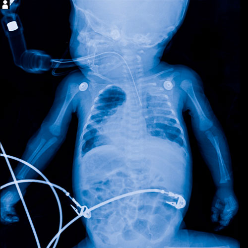 Pediatric Radiology Services