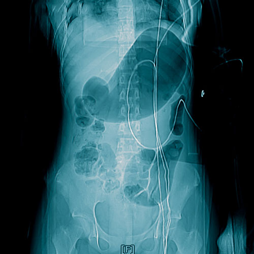 Radiologists CT Scan of the Chest